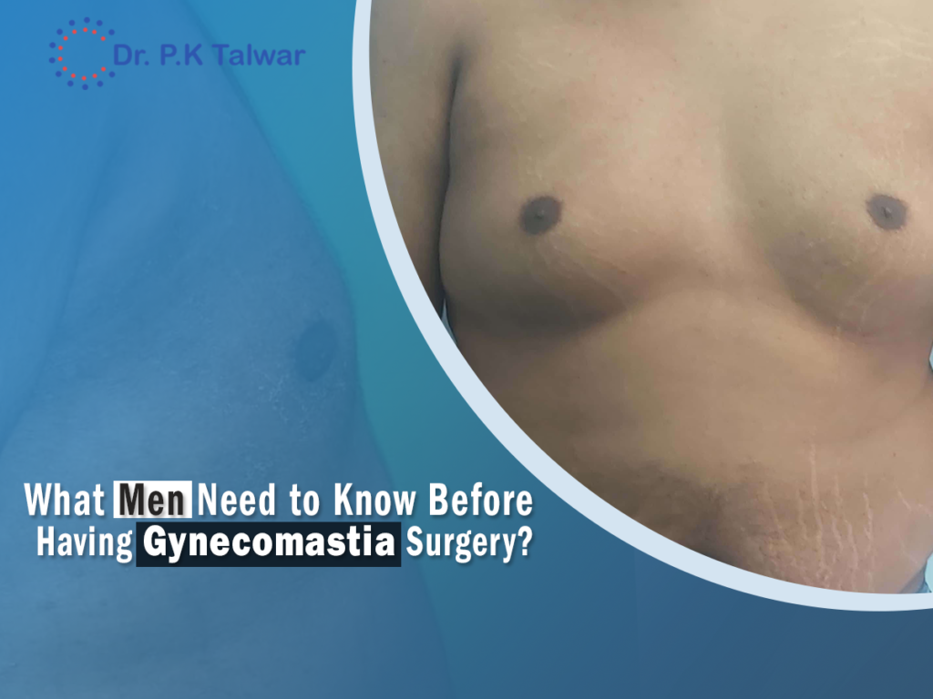 What Men Need to Know Before Having Gynecomastia Surgery?