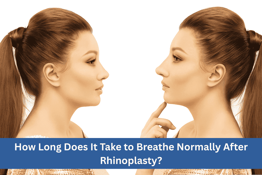 How Long Does It Take to Breathe Normally After Rhinoplasty?