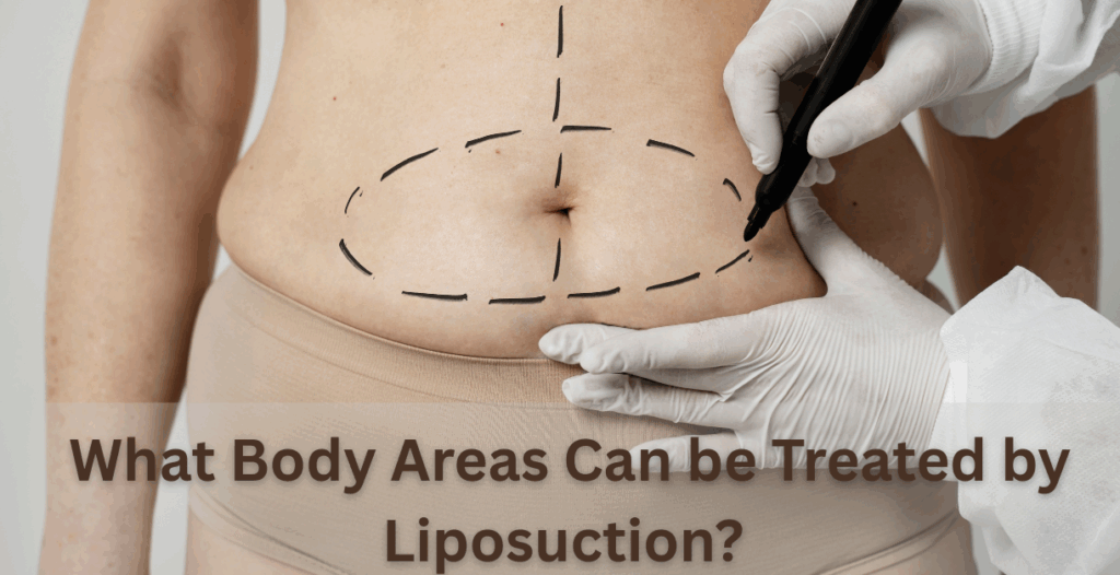 Liposuction Surgery in Delhi