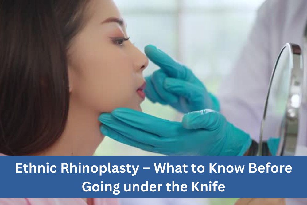 rhinoplasty surgery in delhi