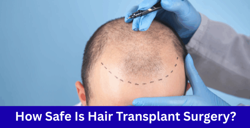 is hair transplant safe​