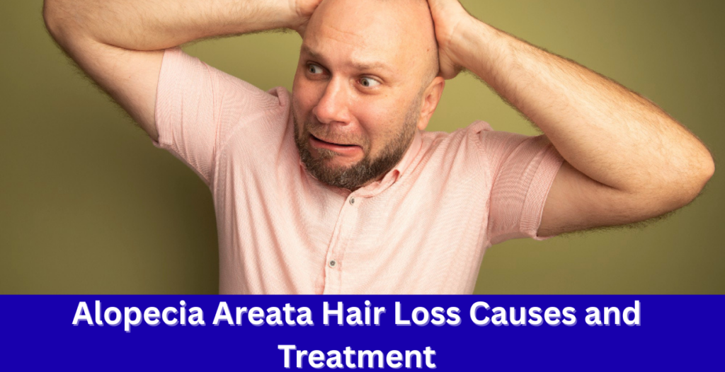Alopecia areata hair loss