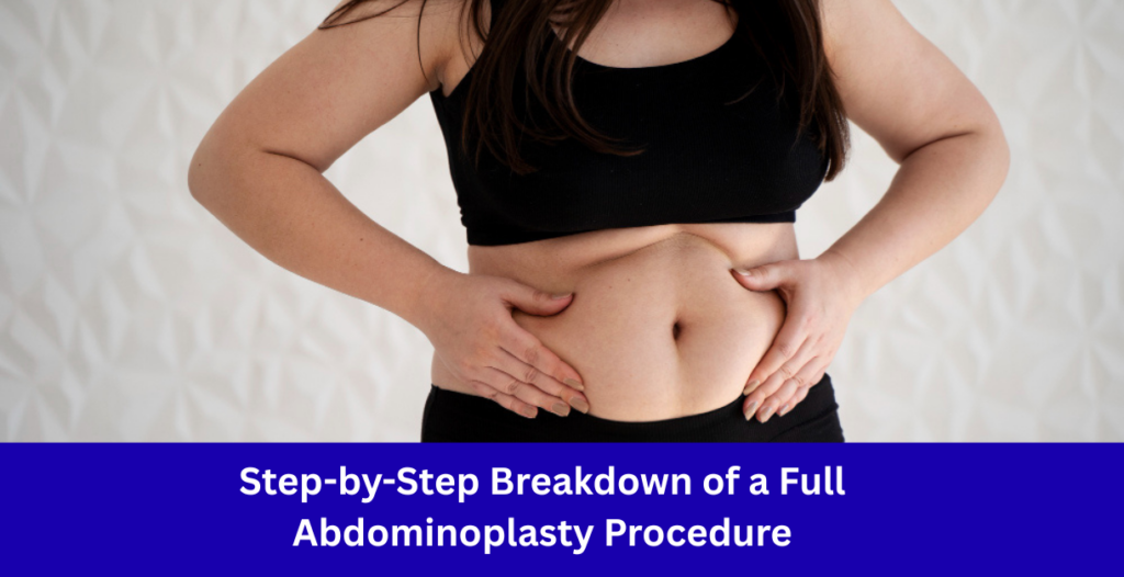 abdominoplasty before and after